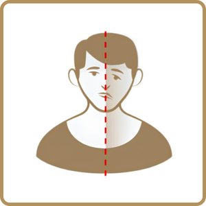 Gejala stroke — wajah turun sebelah atau tidak simetris