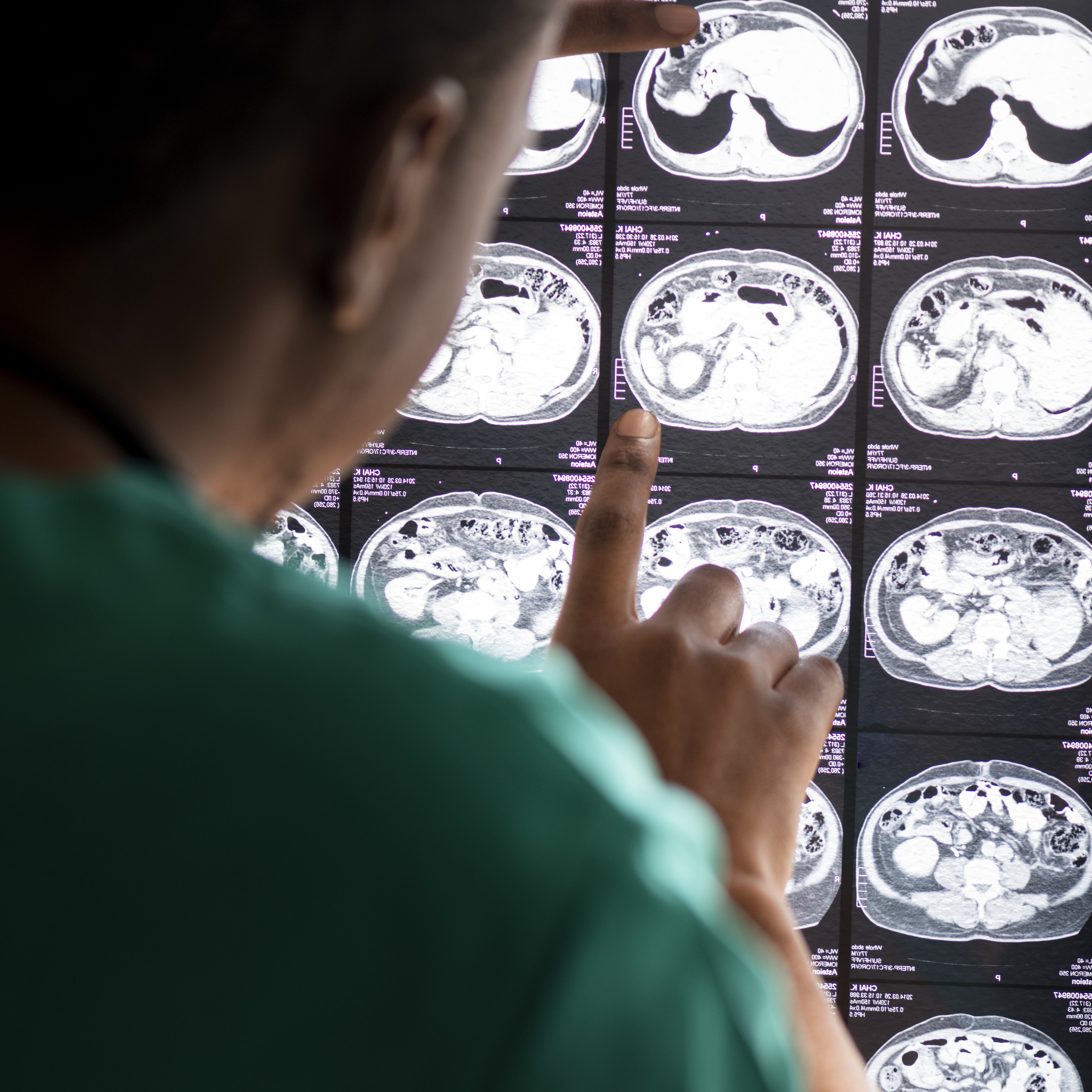 Dokter membaca hasil MRI otak